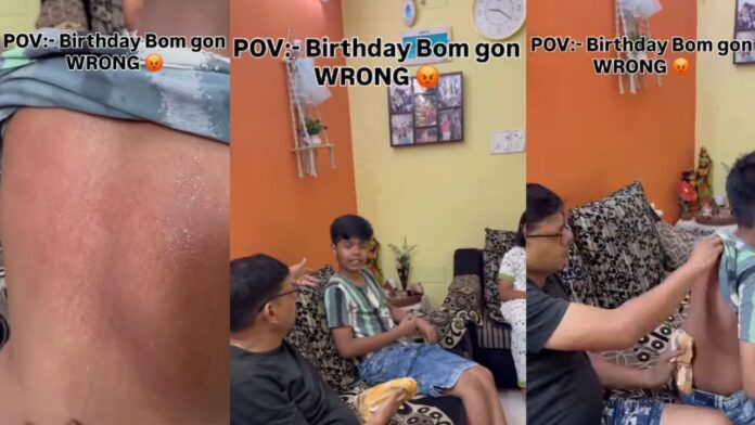 Birthday celebration thrashing Child receives birthday bumps severe leave red marks on back video goes viral Birthday celebration thrashing Child receives birthday bumps severe leave red marks on back video goes viral